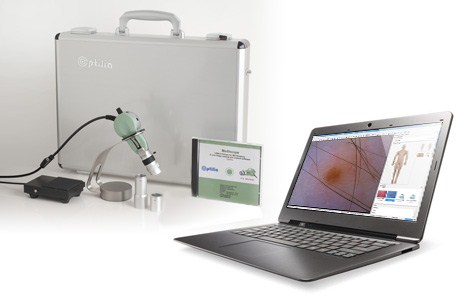 Optilia Digital Dermatoscopy, Standard Kit