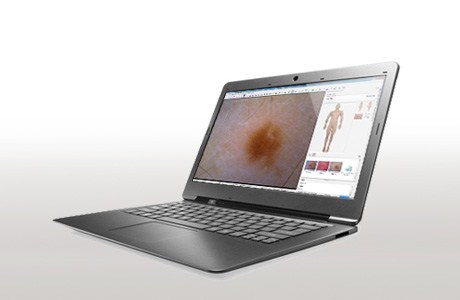 Notebook, Win XPP or Win7, EN, configured for Mediscope