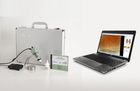 Optilia Digital Capillaroscopy System, Pre-installed with PC or Laptop